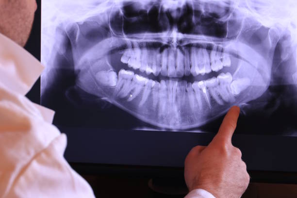 Best Emergency Dental Care for Broken or Chipped Teeth in Greens Farms, CT