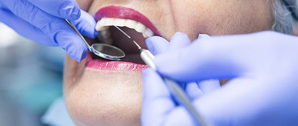 Best Emergency Root Canal Treatment in Greens Farms, CT