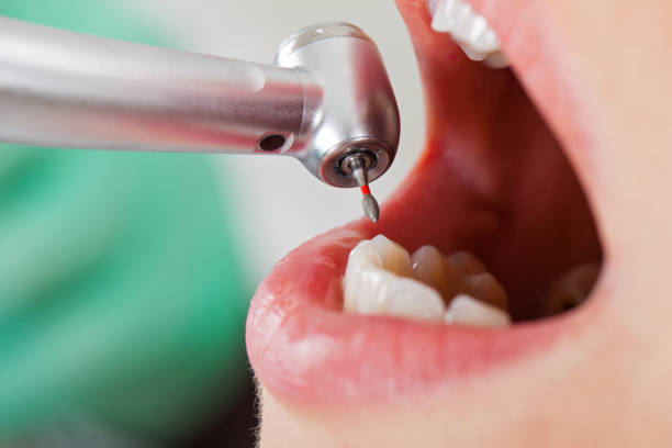 Best Emergency Gum Treatment in Greens Farms, CT